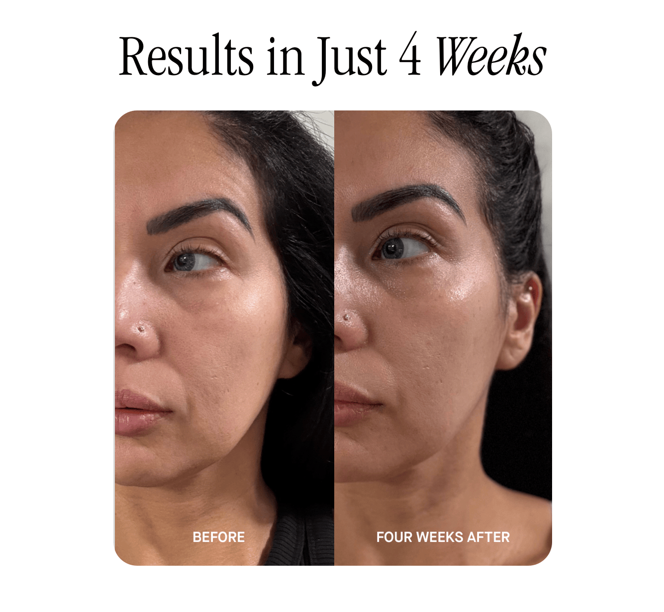 Result in just 4 weeks