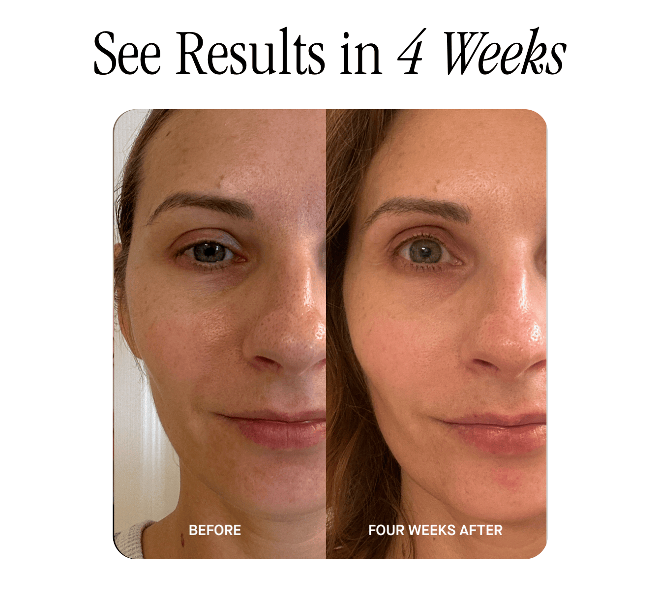 See Results in 4 Weeks