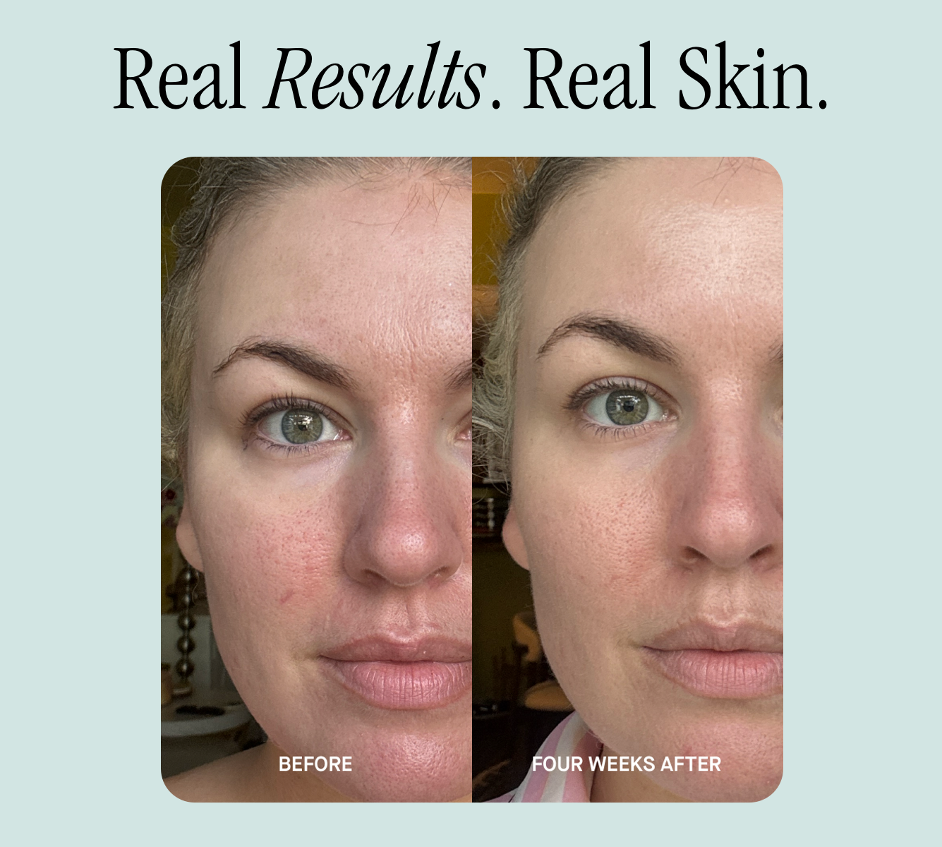 Real Results. Real Skin.
