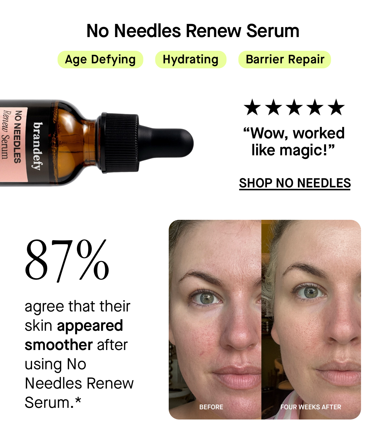 No Needles Renew Serum