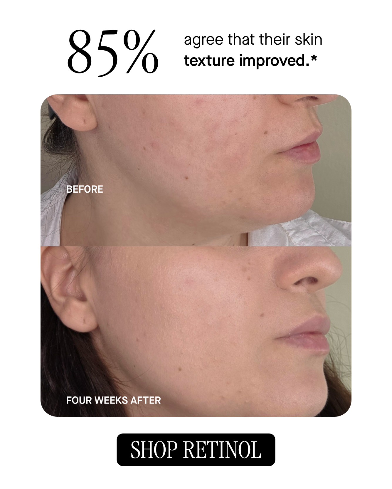 85% agree that their skin texture improved.