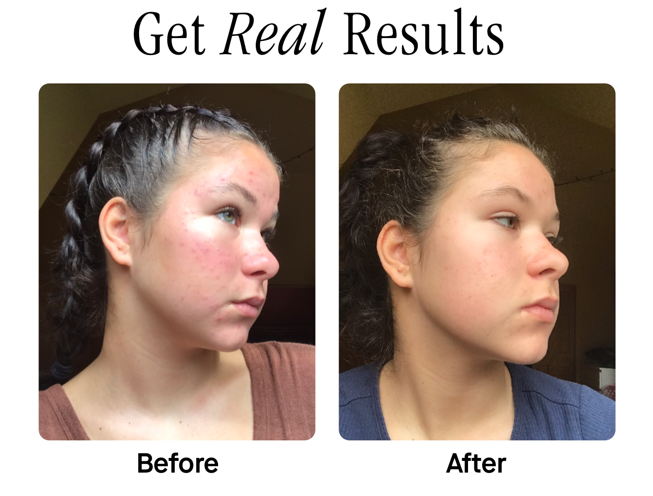 Get Real Results Get Real Results