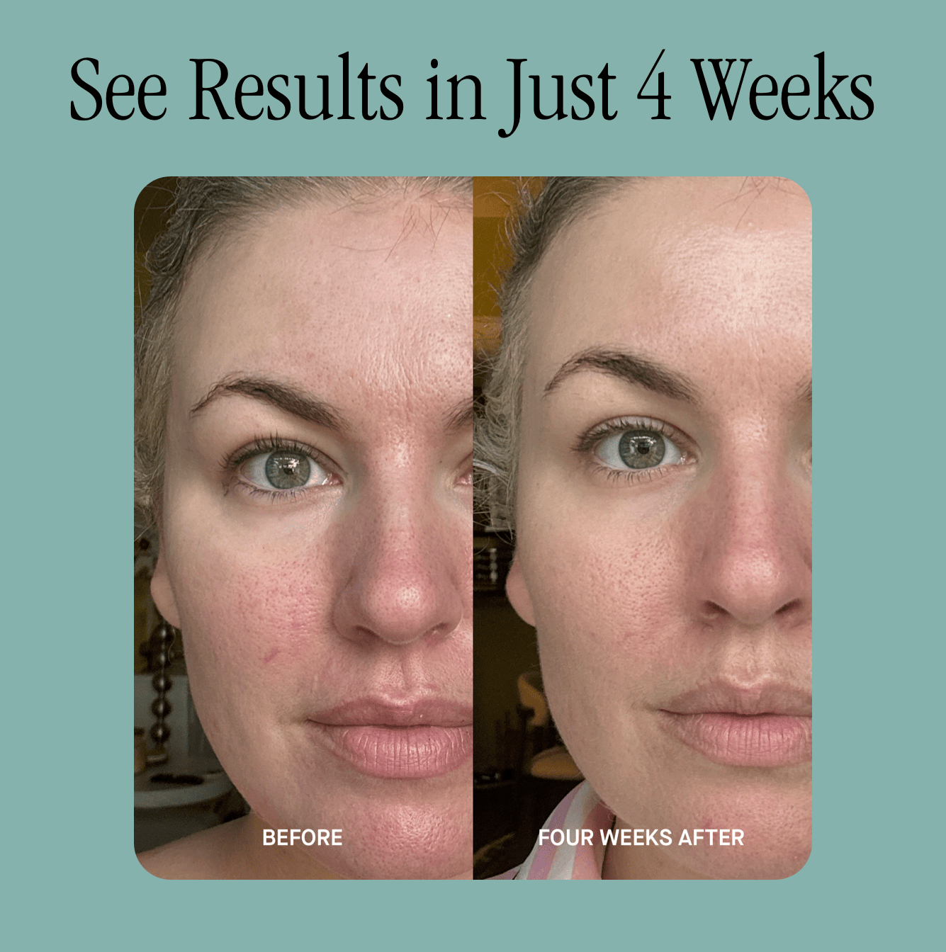 See Results in Just 4 Weeks
