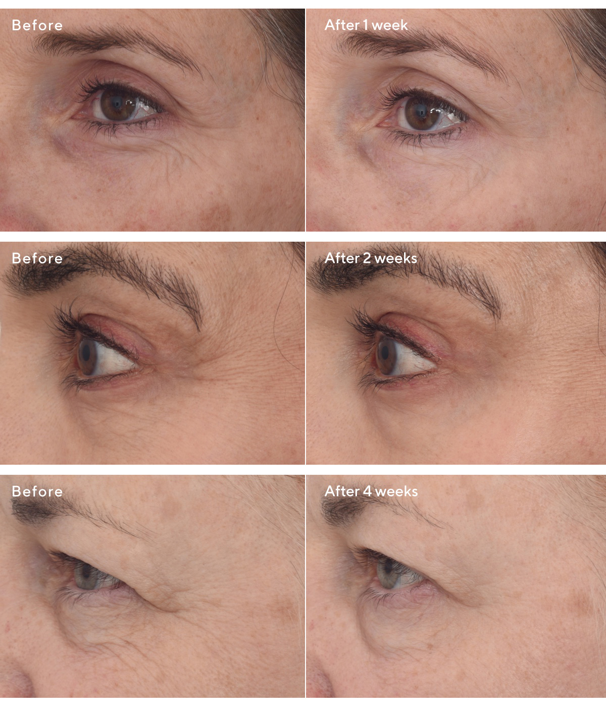 NEW Retinal ReSculpt Eye Lift Treatment Murad