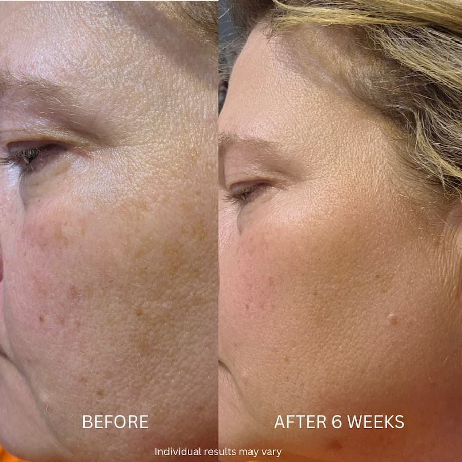 Before and after 6 weeks