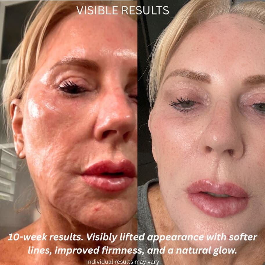 Before and after 6 weeks