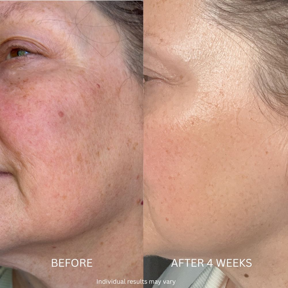 Before and after 8 weeks