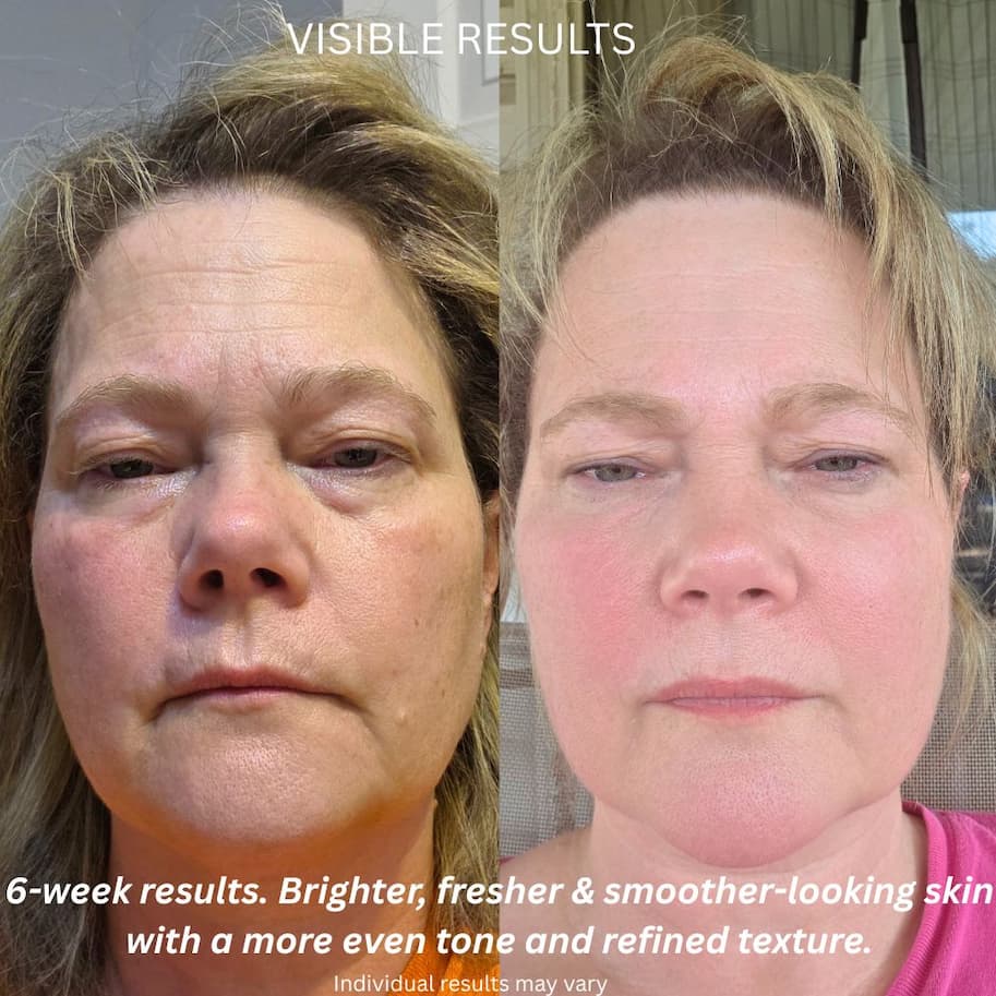 Before and after 4 weeks