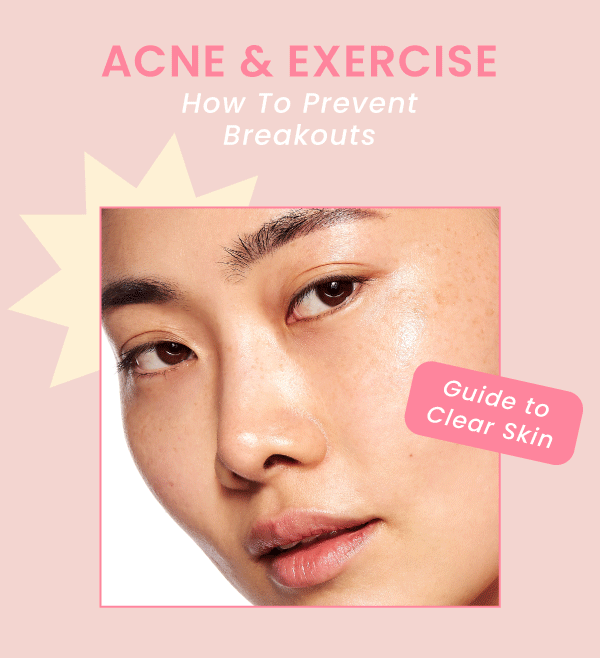 Acne & Exercise How to Prevent Breakouts😊 Timeless Skin Care
