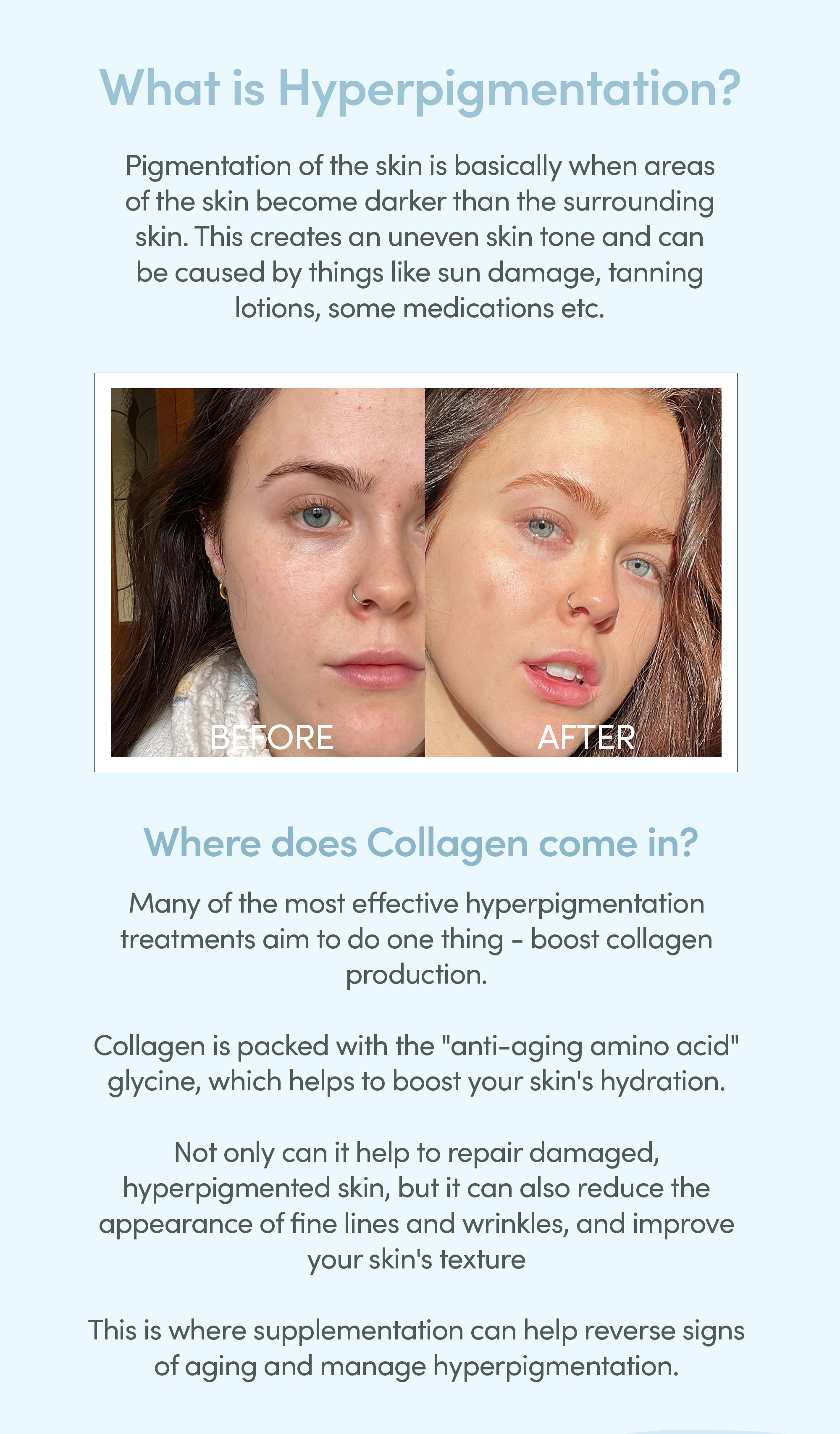 Struggling with uneven skin tone? The Collagen Co.