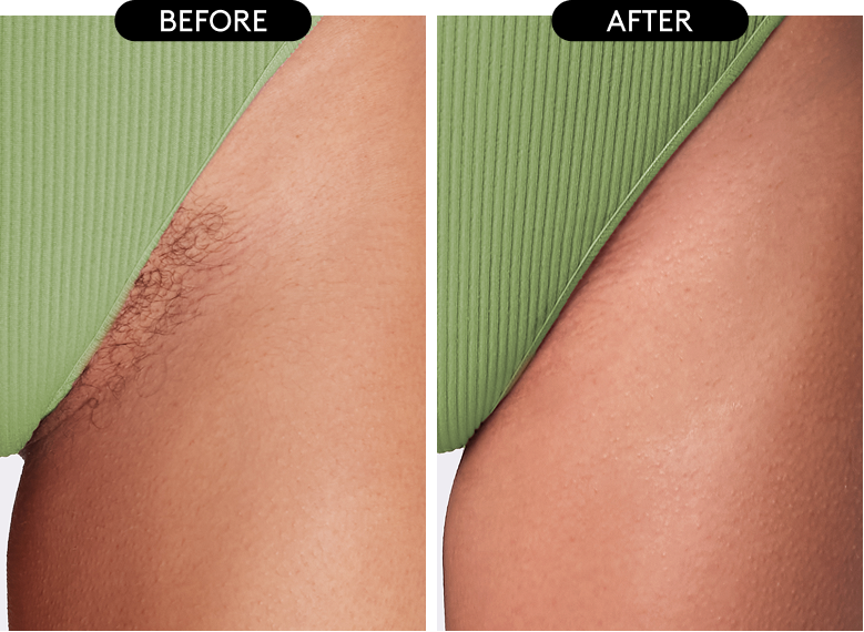before and after