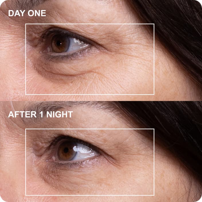 Eye Before and After