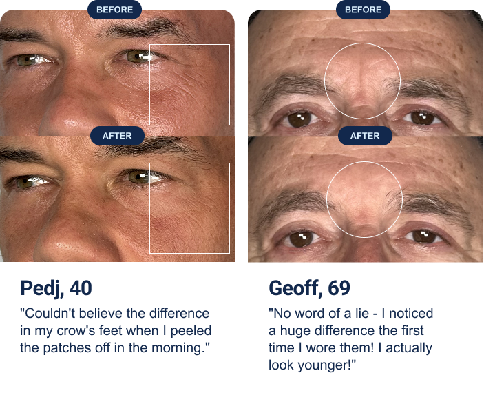 Pedj, 40: "Couldn't believe the difference in my crow's feet when I peeled the patches off in the morning." Geoff, 69: "No word of a lie - I noticed a huge difference the first time I wore them! I actually look younger!"