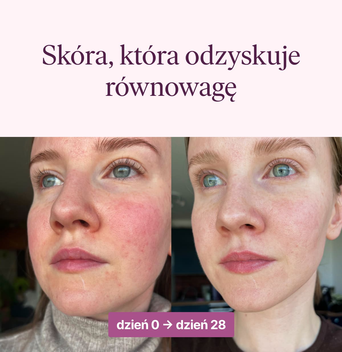 Poznaj Formułę Piękna 