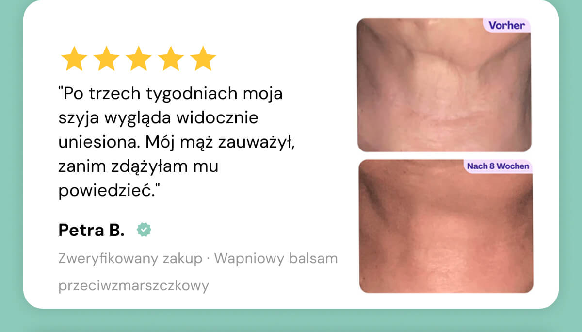 Review 2