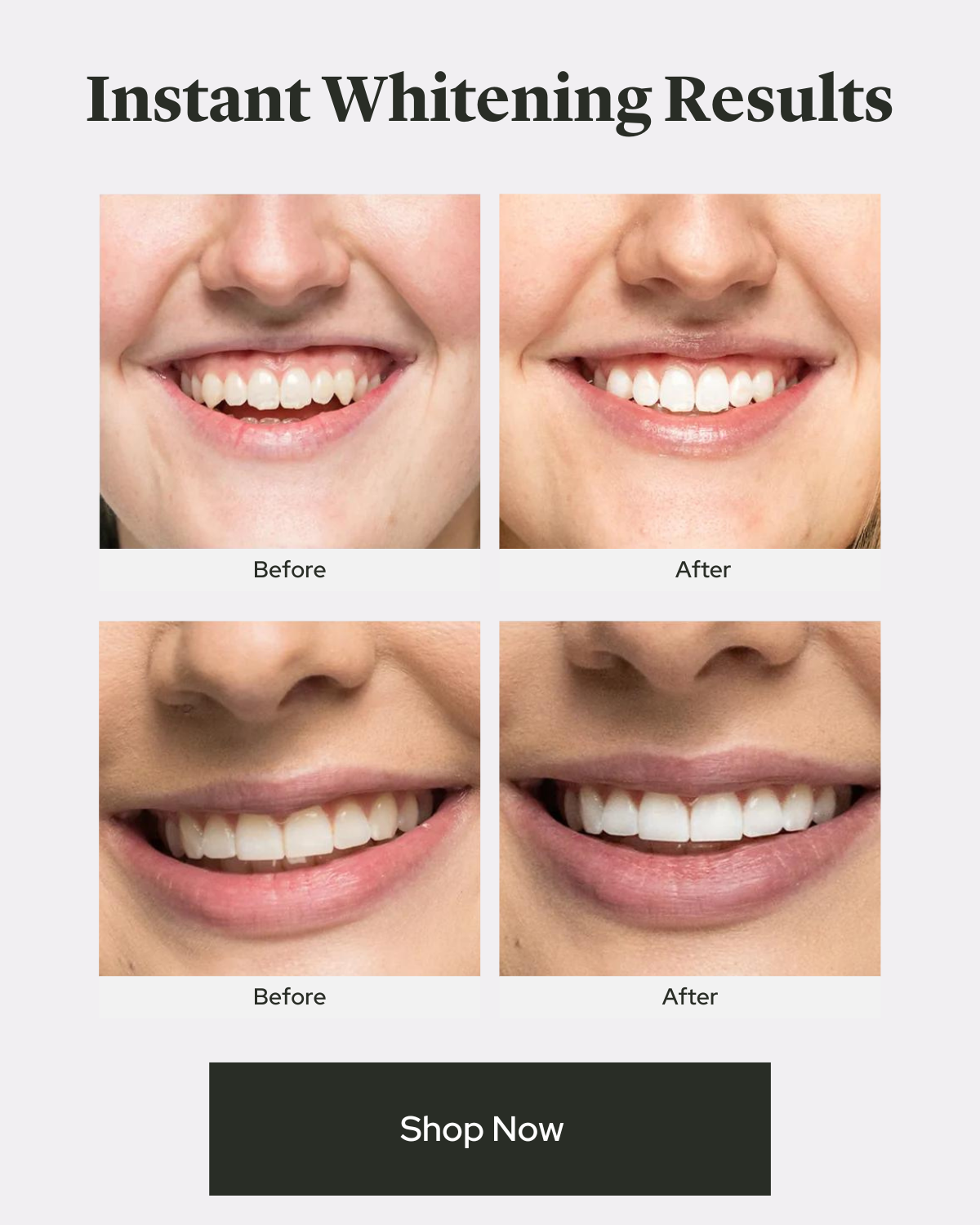Total Whitening Gift Set