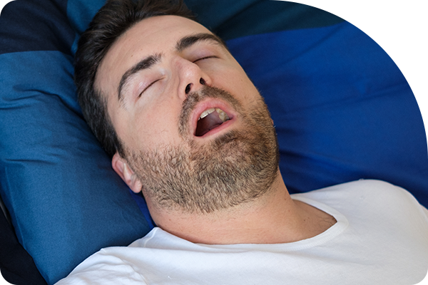 Sleep Apnea