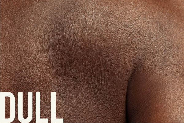 Dull Skin