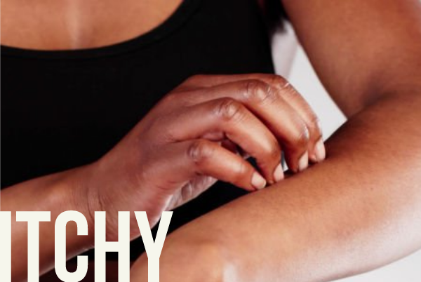 Itchy Skin