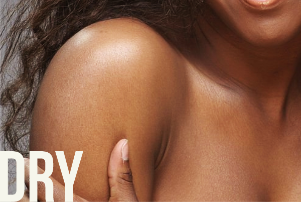 Dry Skin