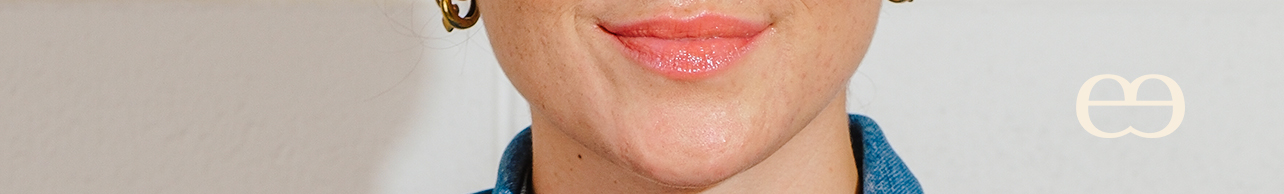 Steens Raw Manuka Honey