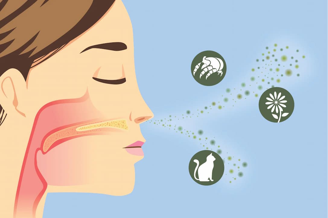 5 Things to Do About Allergy Seasons - Image of woman affected by spring allergies