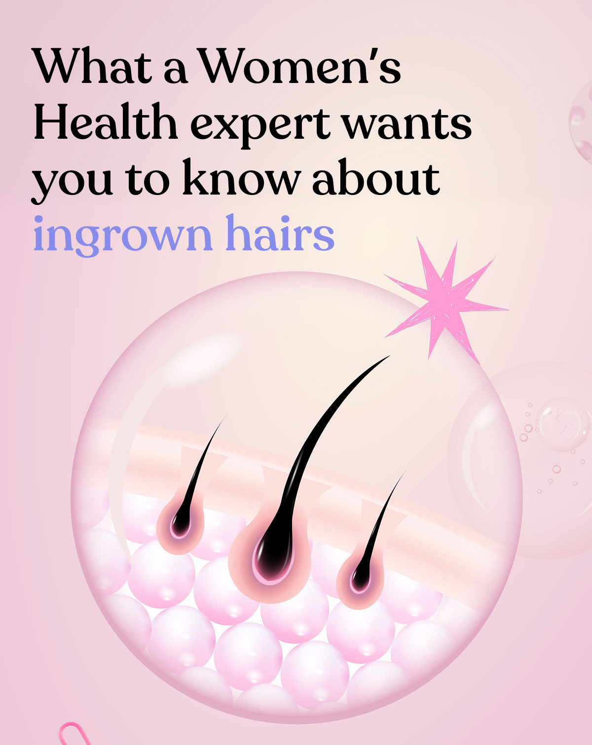 What a Women’s Health expert wants you to know about ingrown hairs