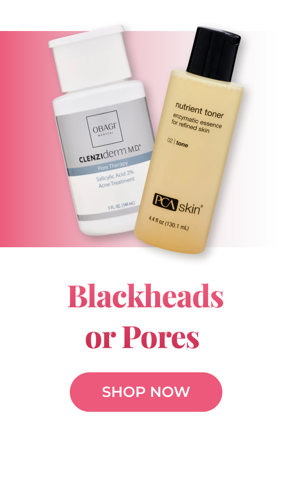 Blackheads or Pores