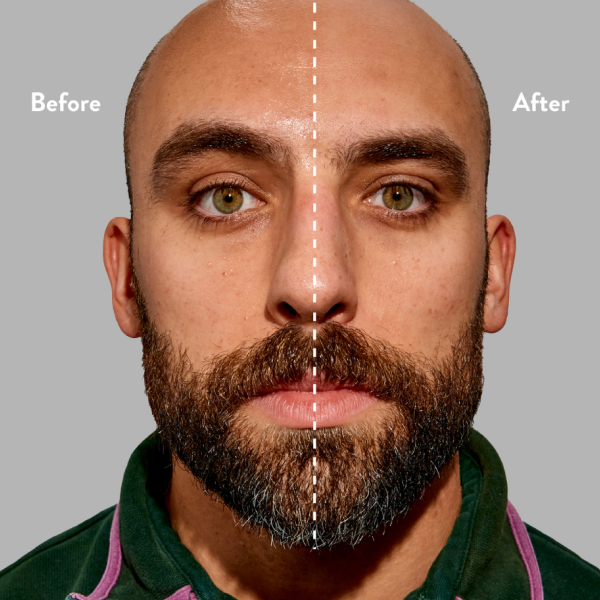 Photo - Before / After