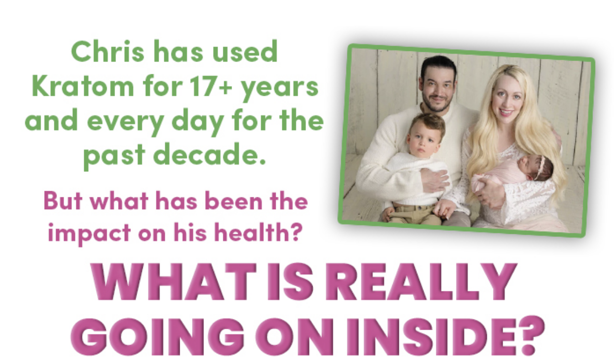 Chris has used Kratom for 17+ years and everyday for the past decade.