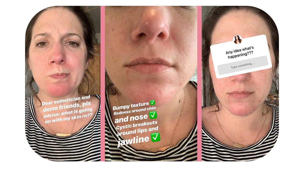 Try This AwardWinning Masque Renee Rouleau