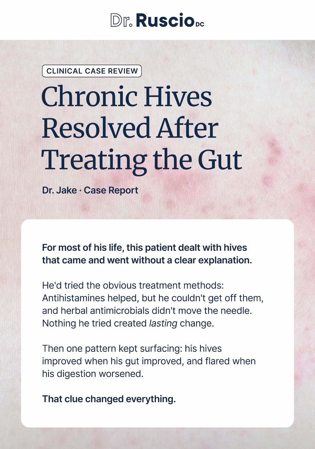 Chronic Hives Resolved After Treating the Gut