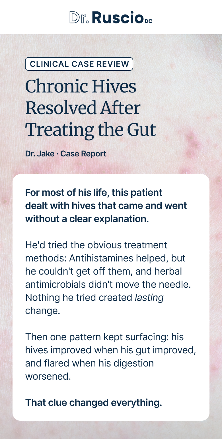 Chronic Hives Resolved After Treating the Gut