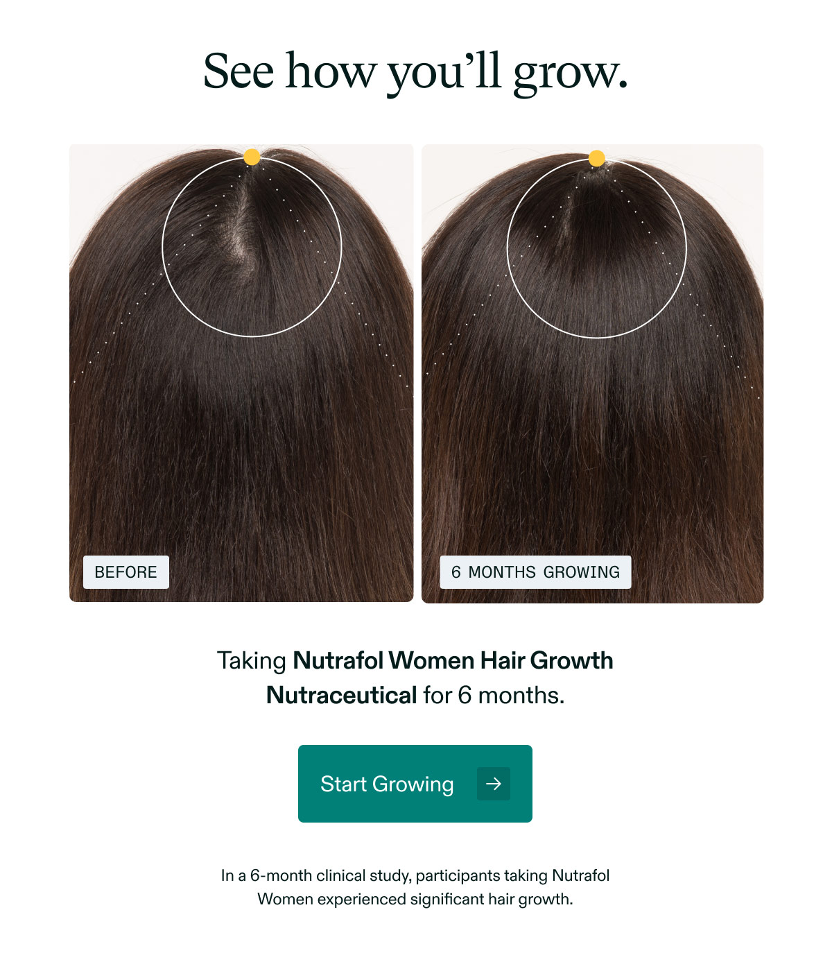 See how you’ll grow. Taking Nutrafol Women Hair Growth Nutraceutical for 6 months.  Start Growing →  In a 6-month clinical study, participants taking Nutrafol Women experienced significant hair growth.