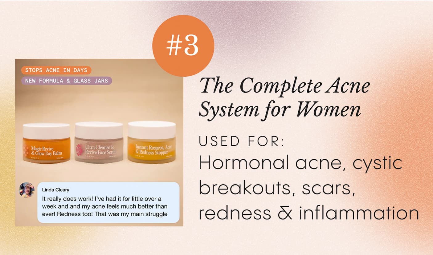 The Complete Acne System for Women