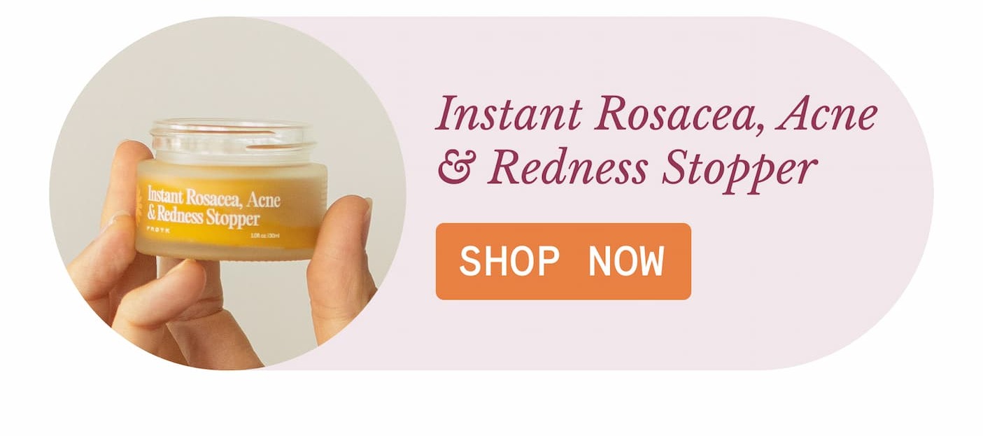 Instant Rosacea, Acne  & Redness Stopper