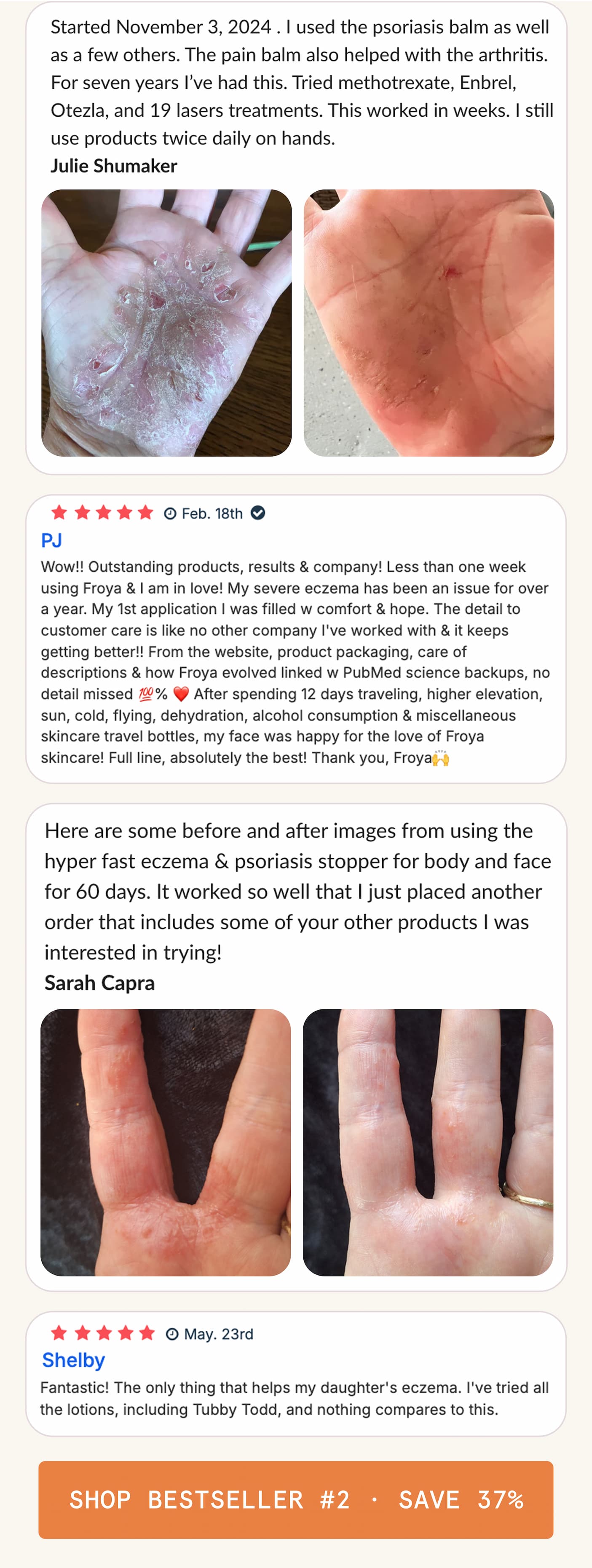 Hyper Fast Eczema & Psoriasis Stopper