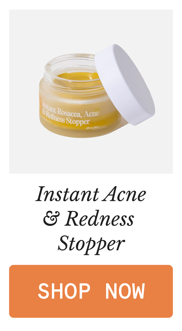 Instant Acne & Redness  Stopper