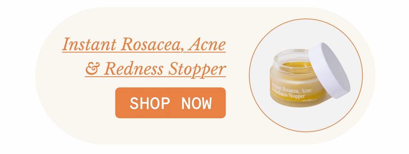 Instant Rosacea, Acne & Redness Stopper