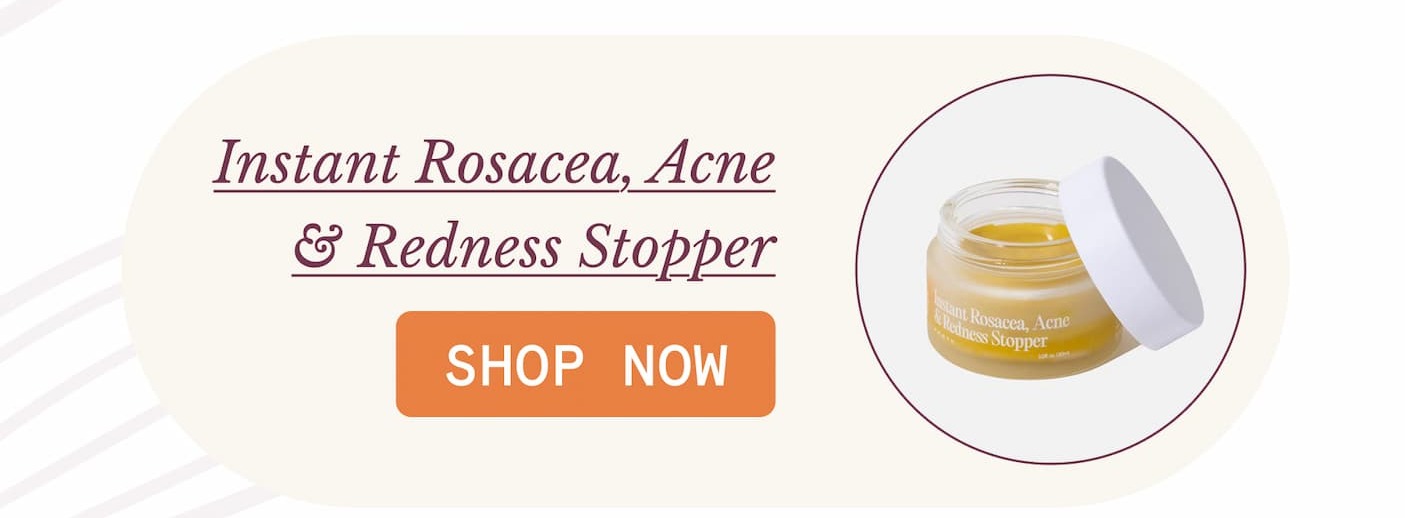 Instant Rosacea, Acne & Redness Stopper