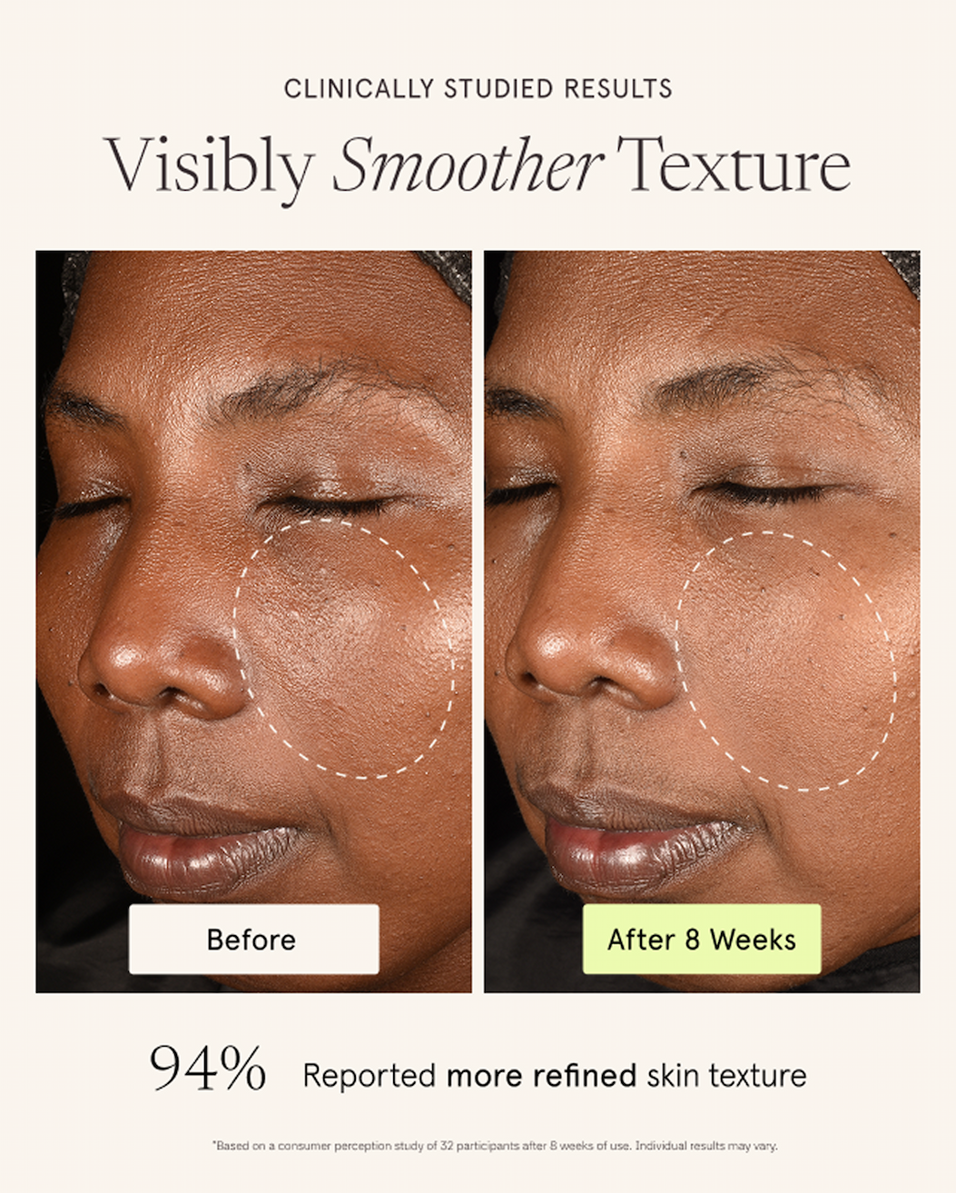 Now Enhanced: RetinAL Skin
