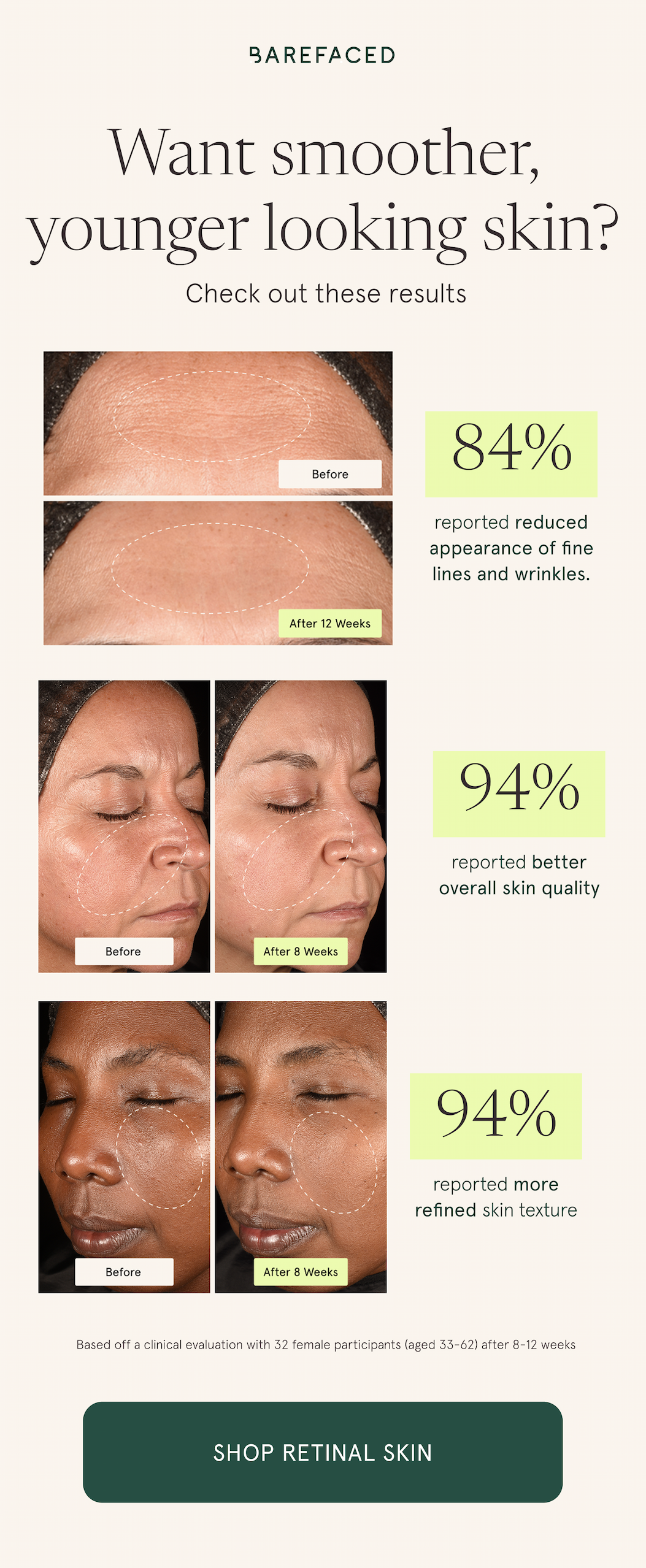 Now Enhanced: RetinAL Skin
