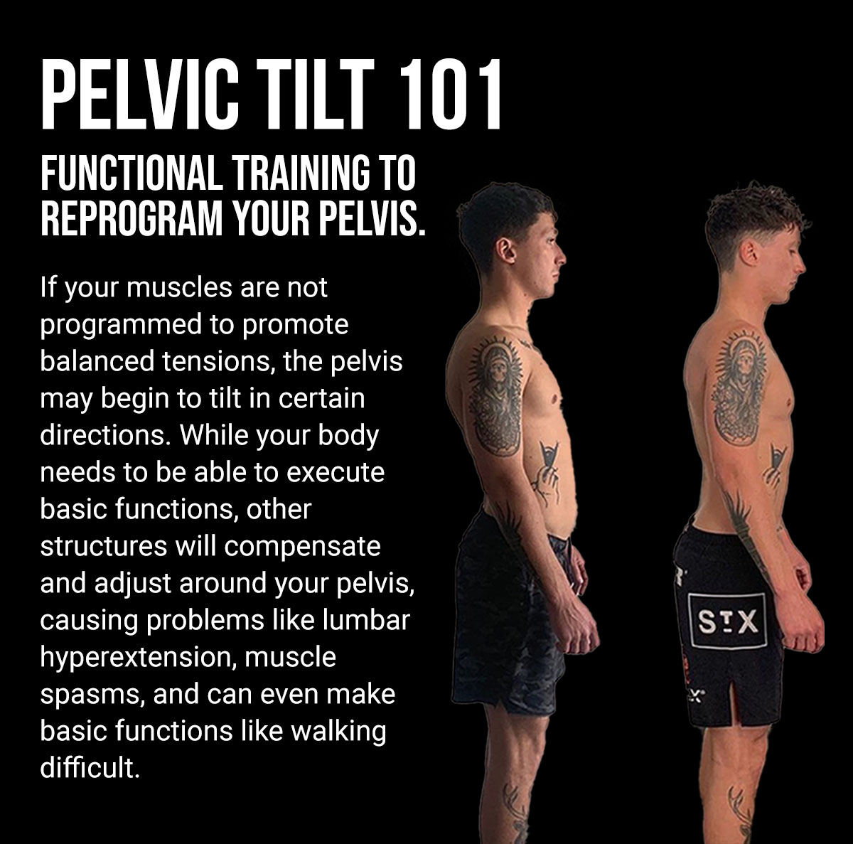 The Truth About Pelvic Tilts Functional Patterns
