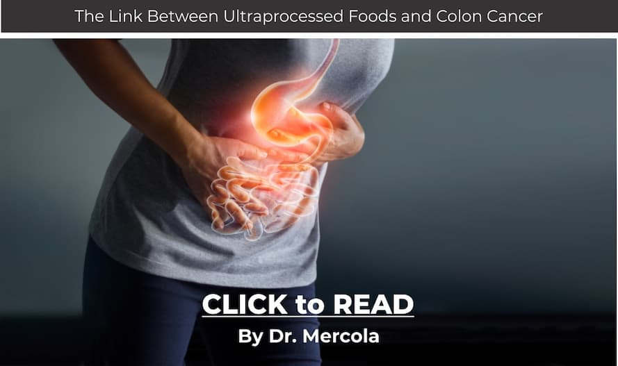 Mercola, colon cancer