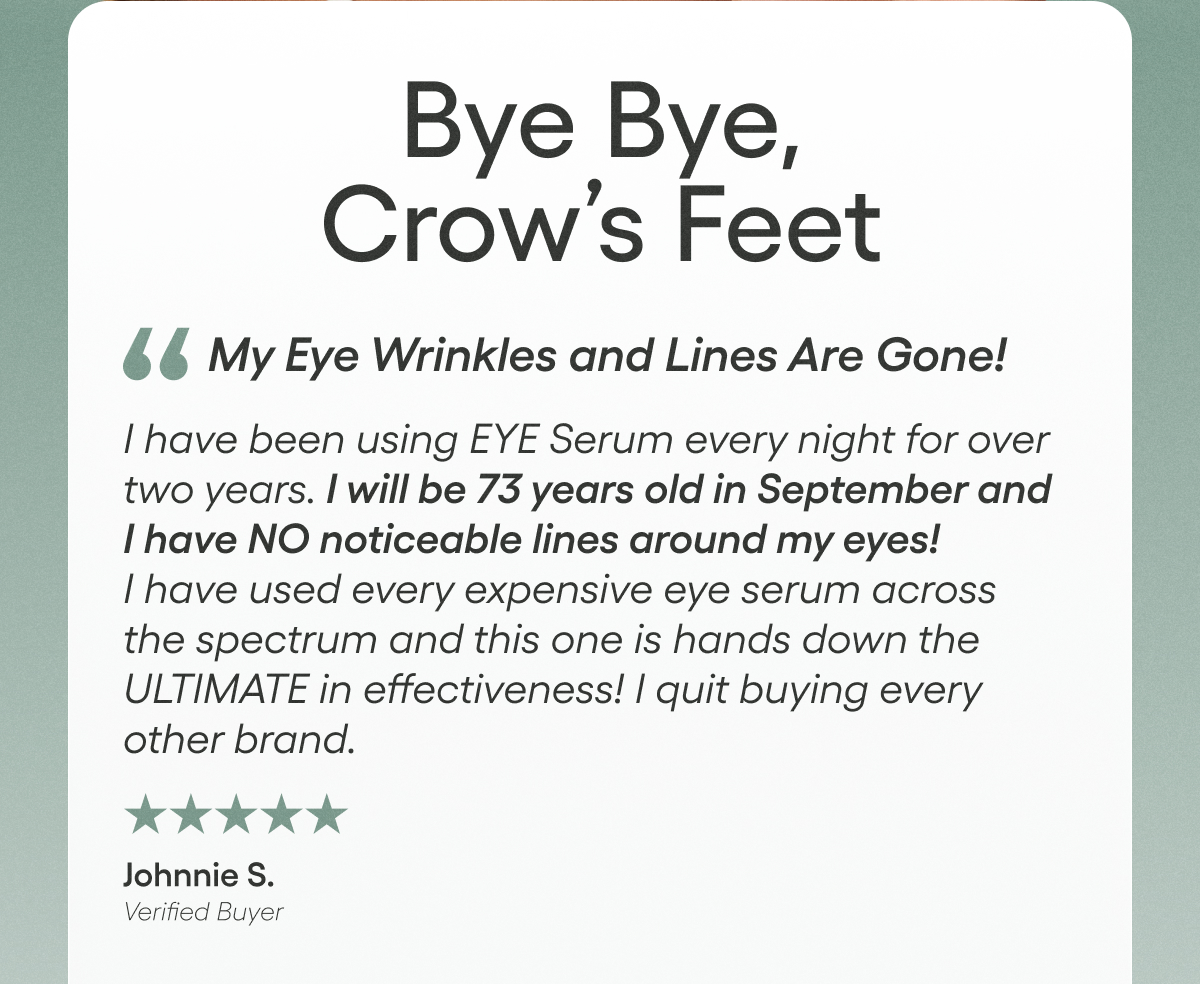 Bye Bye, Crow's Feet | My Eye Wrinkles and Lines Are Gone!