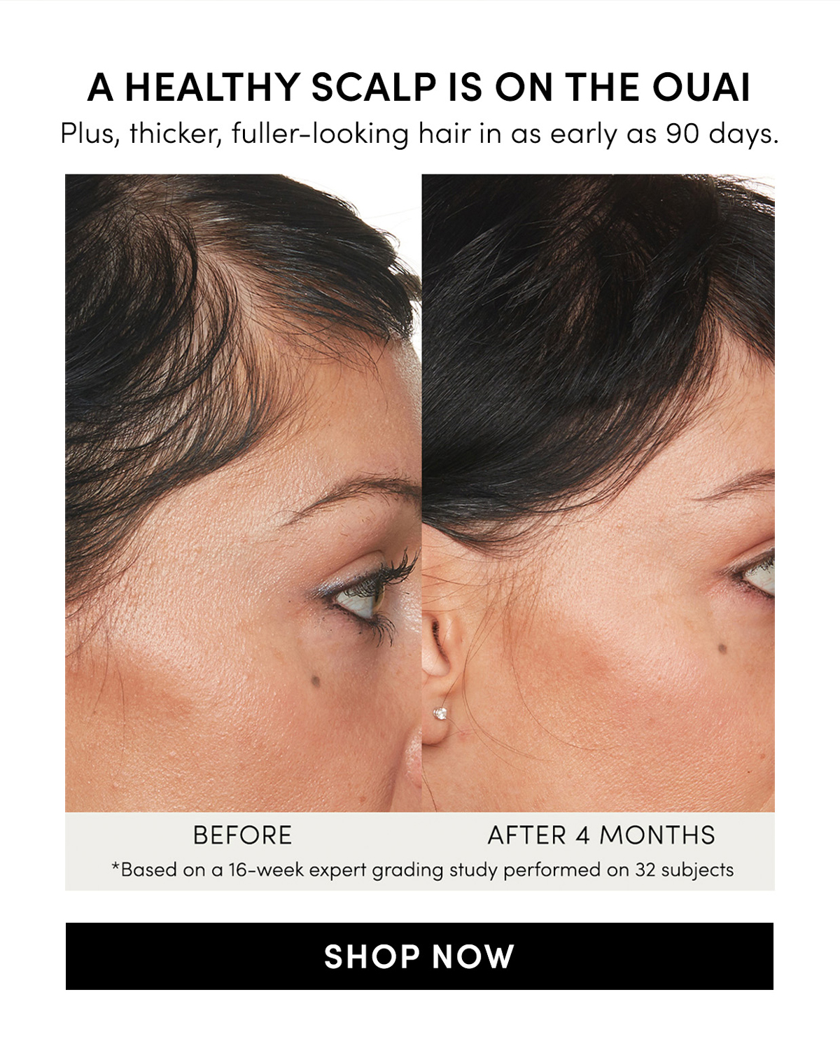 100% saw thicker, fuller-looking hair*