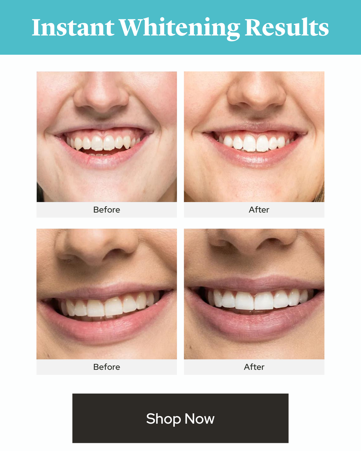 Total Whitening Gift Set