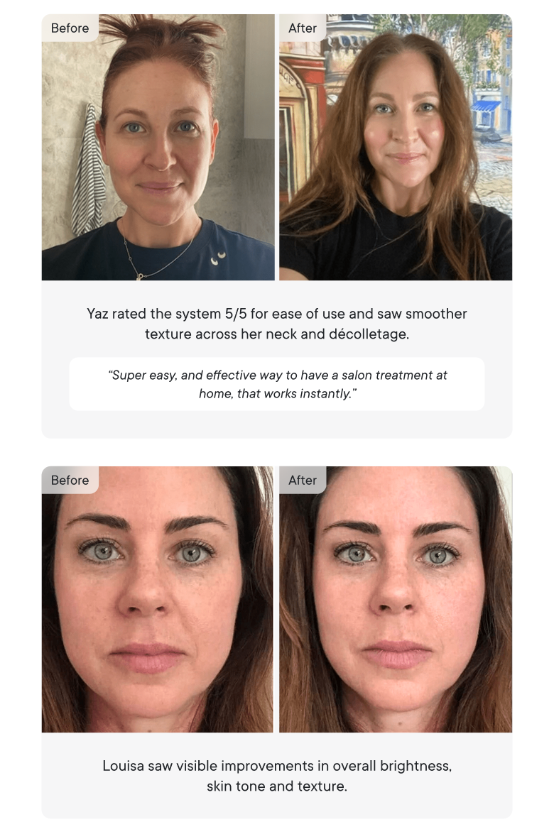 Before & After