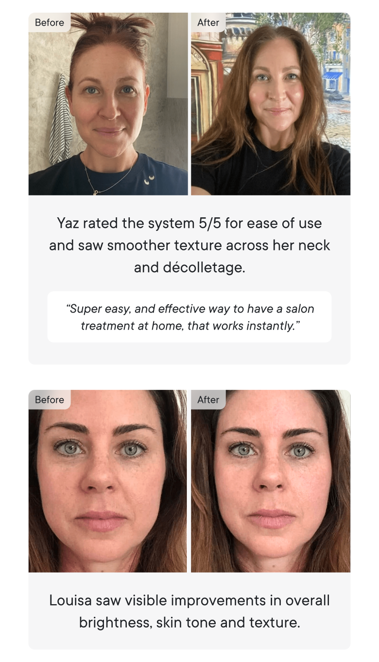 Before & After