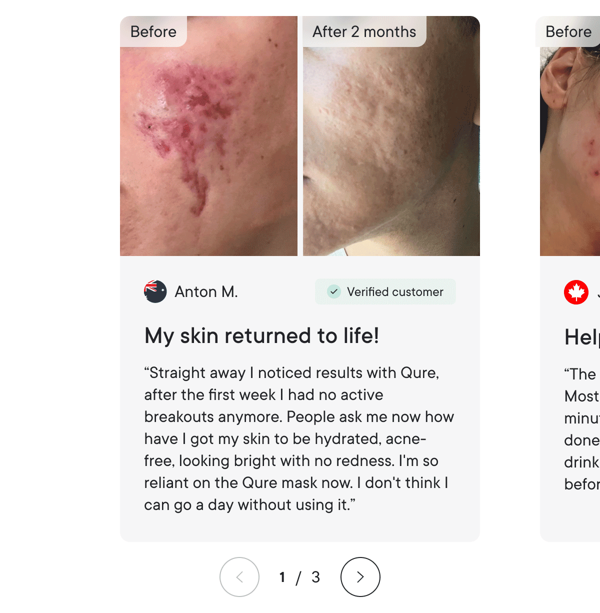 Before & After